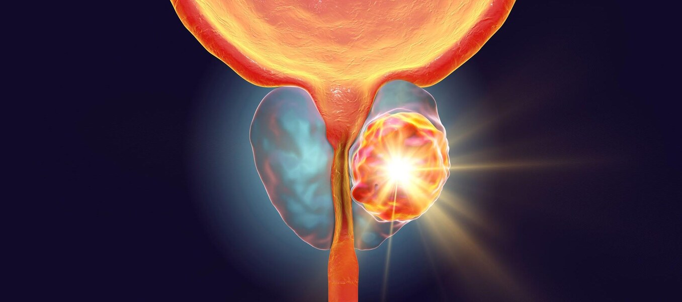 Prostata